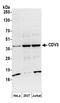 CDV3 Homolog antibody, A304-660A, Bethyl Labs, Western Blot image 