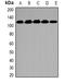 N(Alpha)-Acetyltransferase 16, NatA Auxiliary Subunit antibody, orb388345, Biorbyt, Western Blot image 