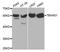 Thromboxane A Synthase 1 antibody, A1988, ABclonal Technology, Western Blot image 