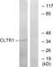 Cysteinyl Leukotriene Receptor 1 antibody, TA315107, Origene, Western Blot image 