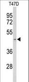 Acrosin antibody, LS-C155966, Lifespan Biosciences, Western Blot image 