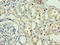 Adrenomedullin antibody, A55846-100, Epigentek, Immunohistochemistry paraffin image 