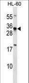 Homeobox B8 antibody, LS-C164983, Lifespan Biosciences, Western Blot image 