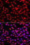 Microtubule-associated tumor suppressor 1 antibody, STJ29738, St John