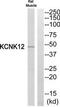 Potassium Two Pore Domain Channel Subfamily K Member 12 antibody, TA315620, Origene, Western Blot image 