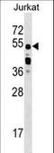 CUGBP Elav-like family member 2 antibody, LS-B10687, Lifespan Biosciences, Western Blot image 