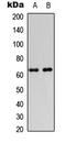 Diacylglycerol Kinase Epsilon antibody, LS-C355994, Lifespan Biosciences, Western Blot image 