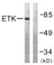 BMX Non-Receptor Tyrosine Kinase antibody, LS-C117805, Lifespan Biosciences, Western Blot image 