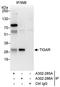 TP53 Induced Glycolysis Regulatory Phosphatase antibody, A302-286A, Bethyl Labs, Immunoprecipitation image 