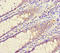 Charged Multivesicular Body Protein 4C antibody, LS-C677530, Lifespan Biosciences, Immunohistochemistry paraffin image 