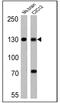 iNOS antibody, MA3-030, Invitrogen Antibodies, Western Blot image 