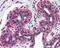 Tumor Protein P73 antibody, 49-338, ProSci, Immunohistochemistry paraffin image 