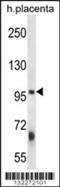 Zinc finger FYVE domain-containing protein 1 antibody, 56-439, ProSci, Western Blot image 