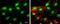 Histone Deacetylase 2 antibody, GTX112957, GeneTex, Immunofluorescence image 