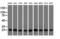 Caseinolytic Mitochondrial Matrix Peptidase Proteolytic Subunit antibody, GTX84679, GeneTex, Western Blot image 
