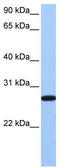 Epithelial Cell Transforming 2 antibody, TA340187, Origene, Western Blot image 