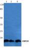 Nuclear Cap Binding Protein Subunit 2 antibody, A08031-1, Boster Biological Technology, Western Blot image 