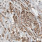 Dicer 1, Ribonuclease III antibody, AMAb90737, Atlas Antibodies, Immunohistochemistry frozen image 