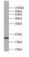 Signal Sequence Receptor Subunit 4 antibody, FNab08249, FineTest, Western Blot image 