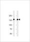 Fms Related Tyrosine Kinase 4 antibody, LS-B10499, Lifespan Biosciences, Western Blot image 