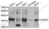 Centromere Protein H antibody, A8372, ABclonal Technology, Western Blot image 