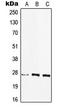 Major Histocompatibility Complex, Class II, DQ Beta 2 antibody, LS-C353729, Lifespan Biosciences, Western Blot image 
