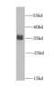 Heterogeneous Nuclear Ribonucleoprotein A0 antibody, FNab03945, FineTest, Western Blot image 