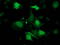 CRBP1 antibody, LS-C172889, Lifespan Biosciences, Immunofluorescence image 