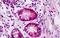 EPH Receptor A3 antibody, MBS248574, MyBioSource, Immunohistochemistry paraffin image 