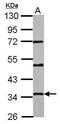 Progestin And AdipoQ Receptor Family Member 6 antibody, PA5-32033, Invitrogen Antibodies, Western Blot image 