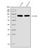 Phospholipase A2 Group IVB antibody, A11137-1, Boster Biological Technology, Western Blot image 