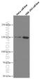 RAB3 GTPase Activating Non-Catalytic Protein Subunit 2 antibody, 66648-1-Ig, Proteintech Group, Western Blot image 