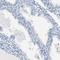 Sperm Adhesion Molecule 1 antibody, HPA017984, Atlas Antibodies, Immunohistochemistry frozen image 