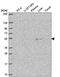 Chromosome 3 Open Reading Frame 67 antibody, PA5-67066, Invitrogen Antibodies, Western Blot image 