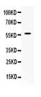 Apurinic/Apyrimidinic Endodeoxyribonuclease 2 antibody, LS-C662254, Lifespan Biosciences, Western Blot image 