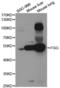 Fibrinogen Gamma Chain antibody, TA332808, Origene, Western Blot image 