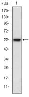 Mitogen-Activated Protein Kinase Kinase Kinase 5 antibody, STJ97852, St John