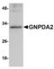 Glucosamine-6-Phosphate Deaminase 2 antibody, MBS150148, MyBioSource, Western Blot image 