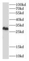 Canopy FGF Signaling Regulator 4 antibody, FNab01817, FineTest, Western Blot image 