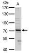 E3 ubiquitin-protein ligase TRIM32 antibody, TA308451, Origene, Western Blot image 