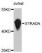 STE20 Related Adaptor Alpha antibody, A10336, ABclonal Technology, Western Blot image 