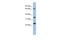 TBC1 Domain Family Member 25 antibody, A11691, Boster Biological Technology, Western Blot image 