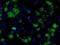 Fumarylacetoacetate Hydrolase Domain Containing 2A antibody, NBP2-02331, Novus Biologicals, Immunocytochemistry image 