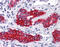 Keratin 15 antibody, 51-384, ProSci, Immunohistochemistry paraffin image 