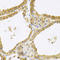 Four And A Half LIM Domains 1 antibody, A01258, Boster Biological Technology, Immunohistochemistry paraffin image 