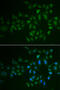 Putative myosin light chain kinase 3 antibody, abx005109, Abbexa, Western Blot image 