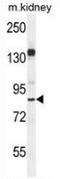Histone H2A deubiquitinase MYSM1 antibody, AP52802PU-N, Origene, Western Blot image 