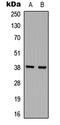 Heterogeneous Nuclear Ribonucleoprotein D antibody, LS-C356107, Lifespan Biosciences, Western Blot image 