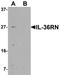 Interleukin-1 family member 5 antibody, TA326668, Origene, Western Blot image 