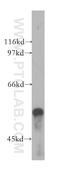 Transducin Beta Like 1 X-Linked antibody, 13540-1-AP, Proteintech Group, Western Blot image 
